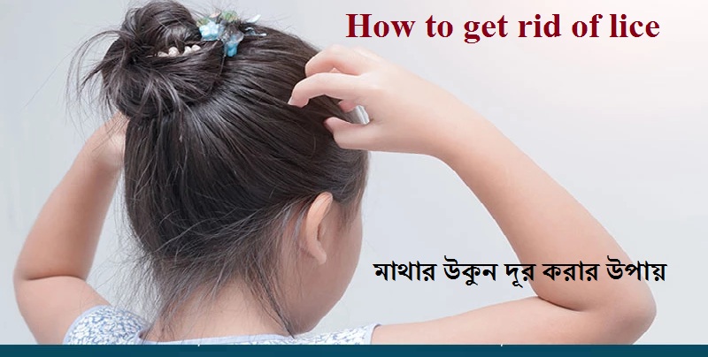 how to get rid of lice